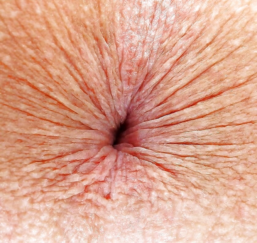 Ass hole up close