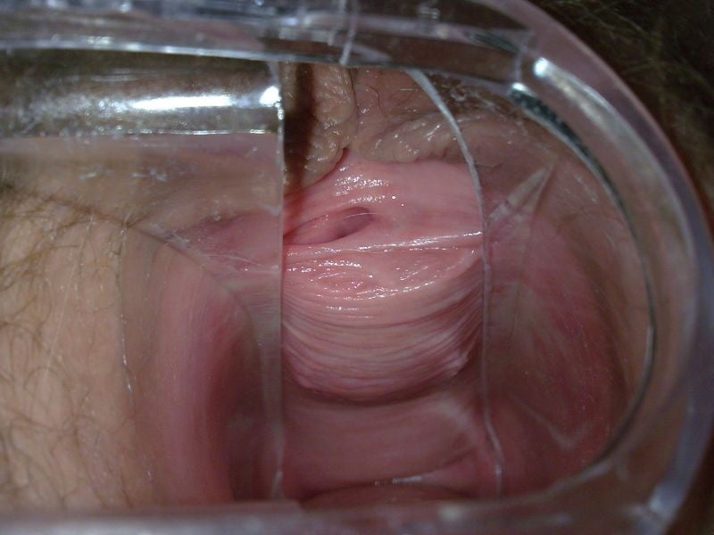 Строение вагины изнутри 65 фото