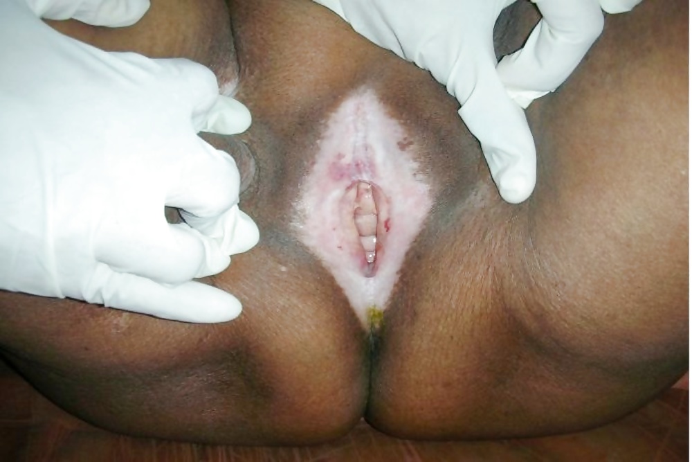 Somalia woman fuck 6 guys her vagina
