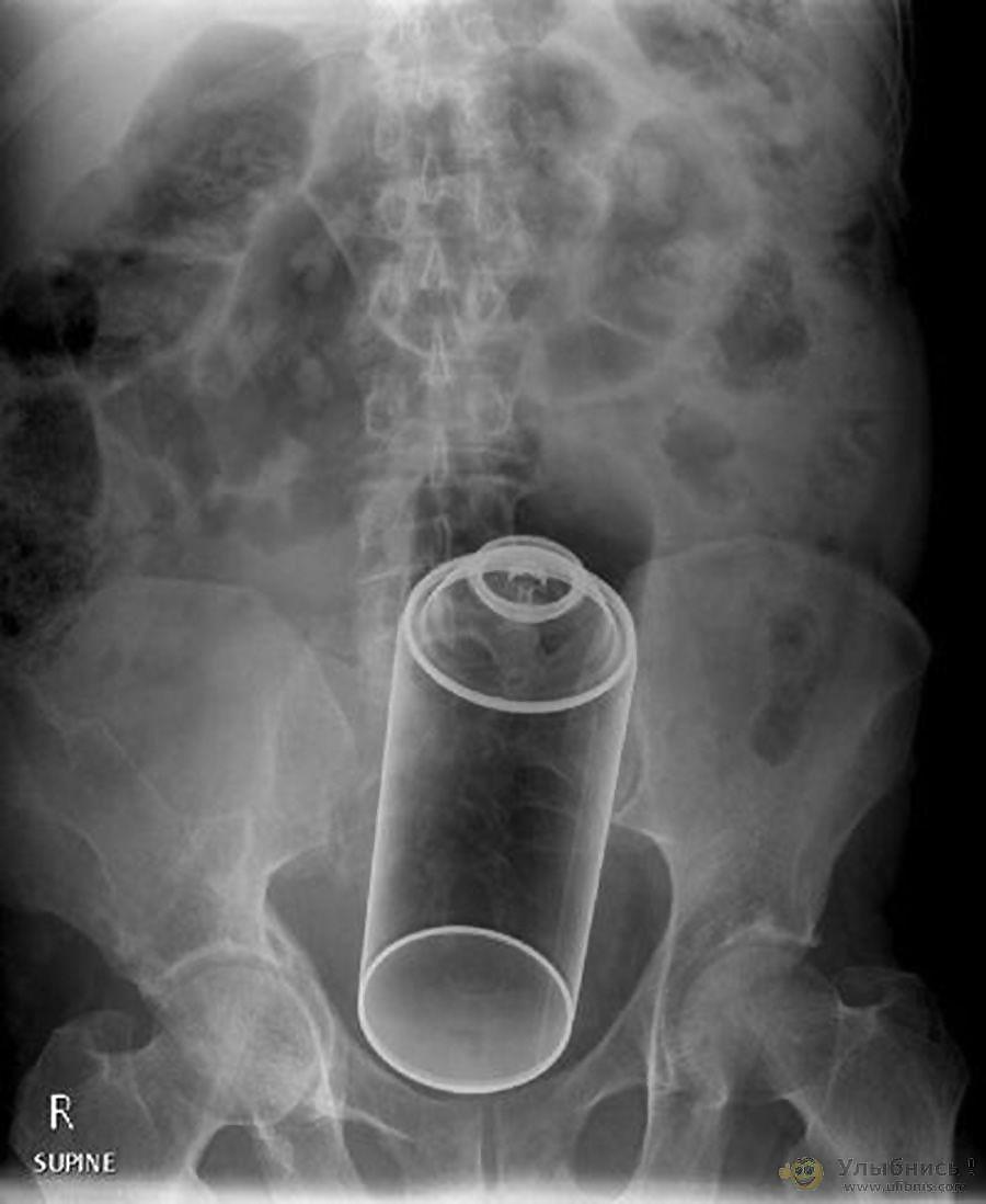Free x-ray photos