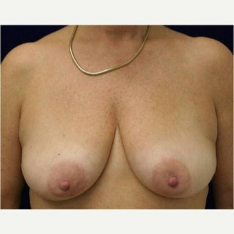 45-54 saggy breasts vol 2 - 94 Photos 