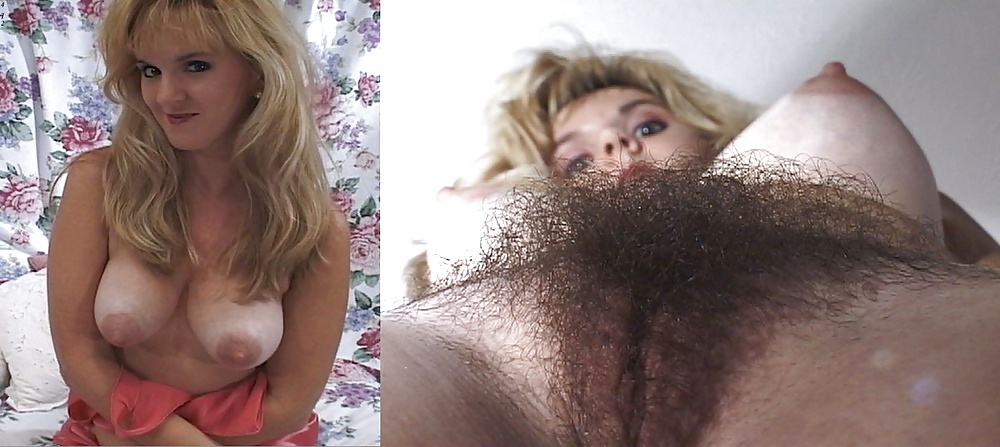 Free dressed undressed photos