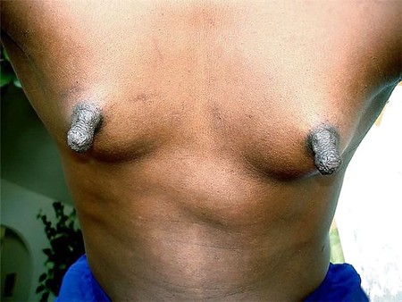 Huge African Nipples