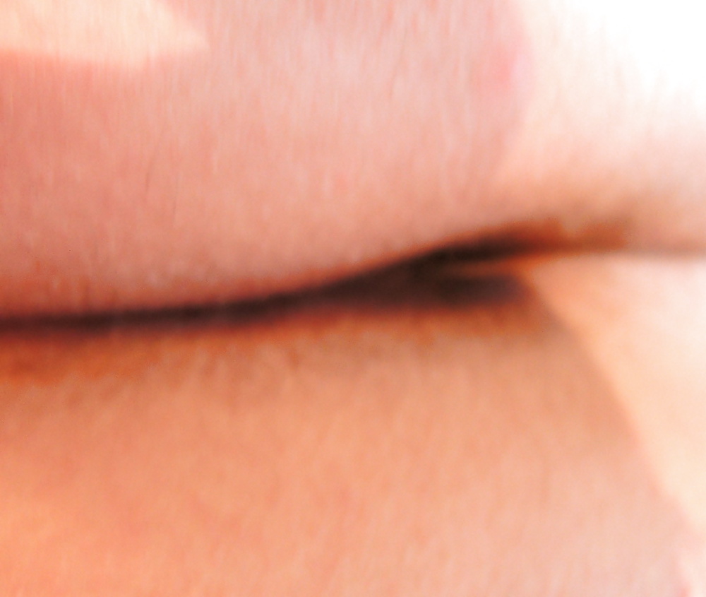 Free My teen butthole last night photos