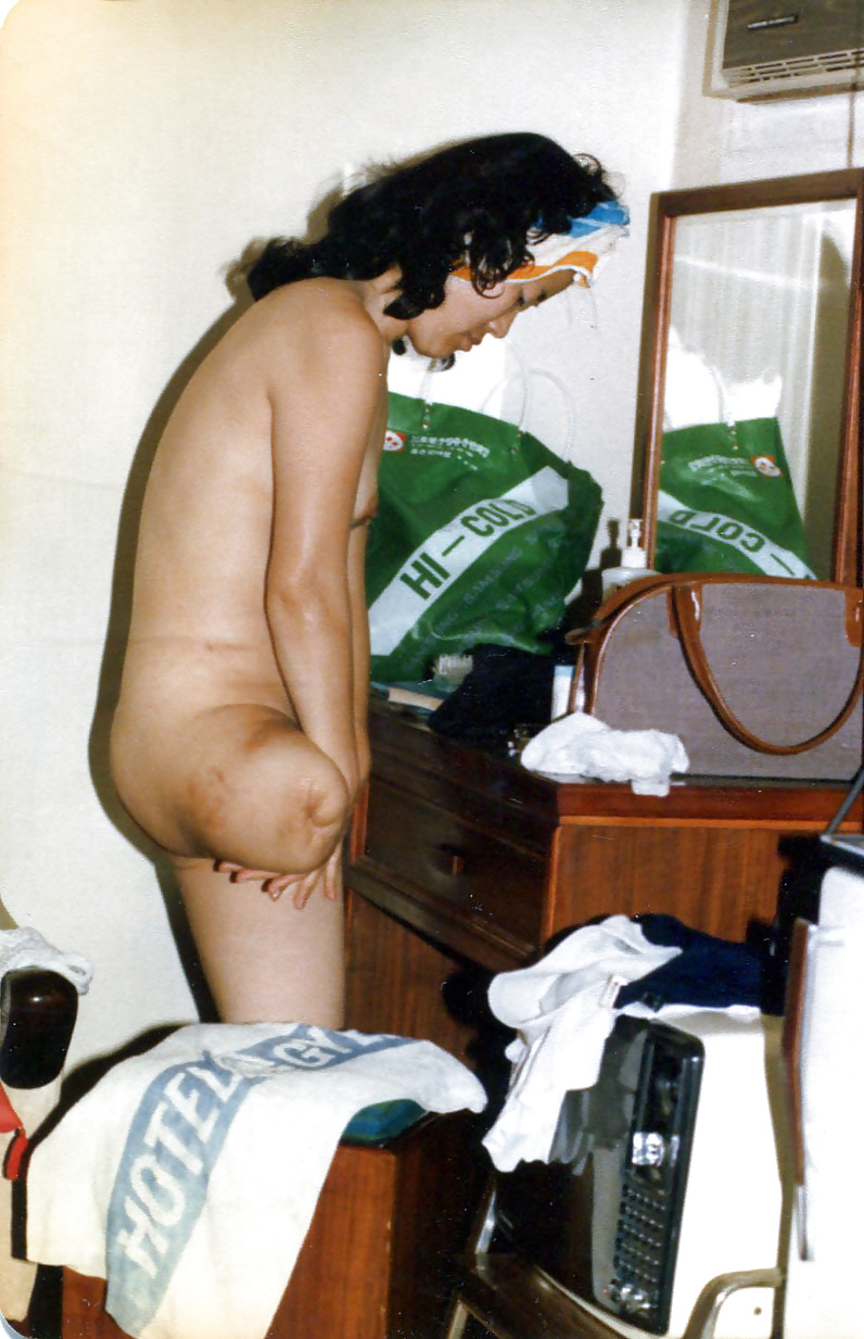 Free Various amputee girls photos