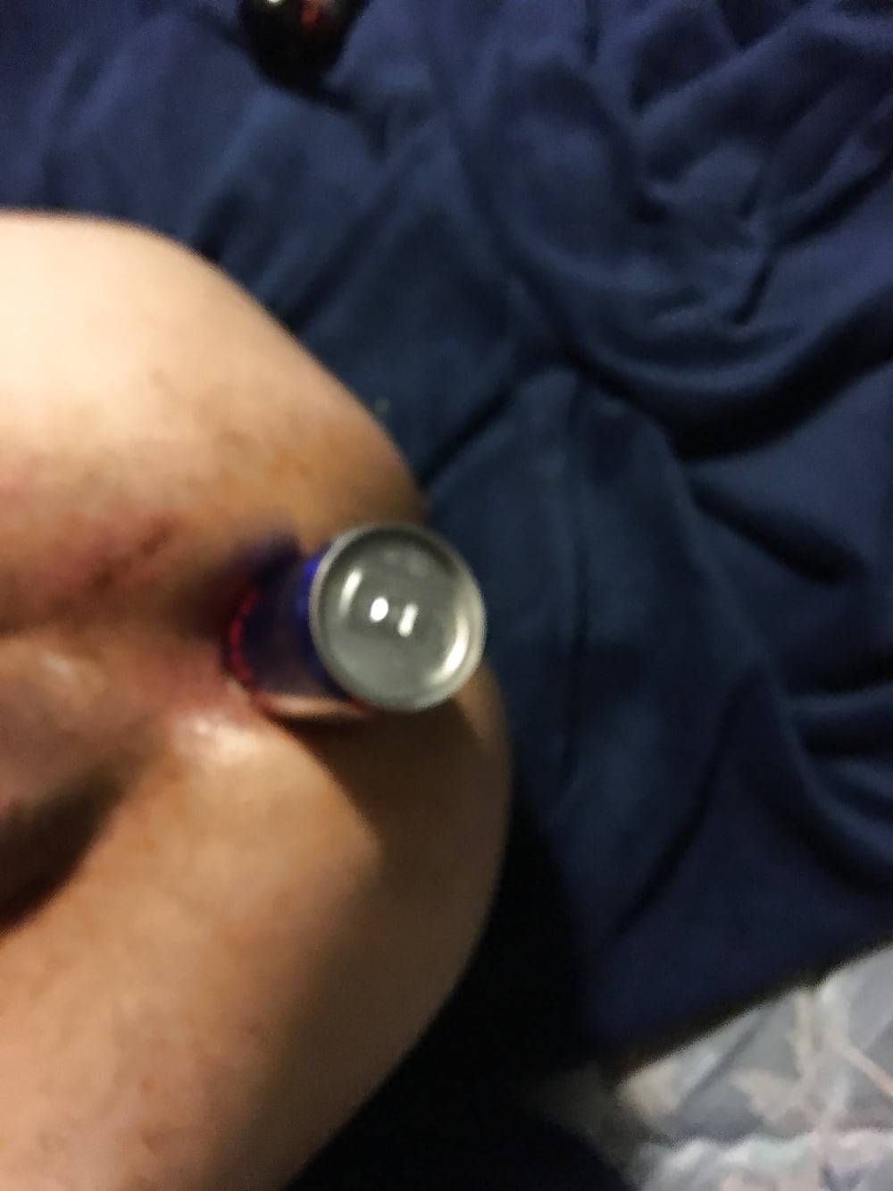 Free Anal insertions photos