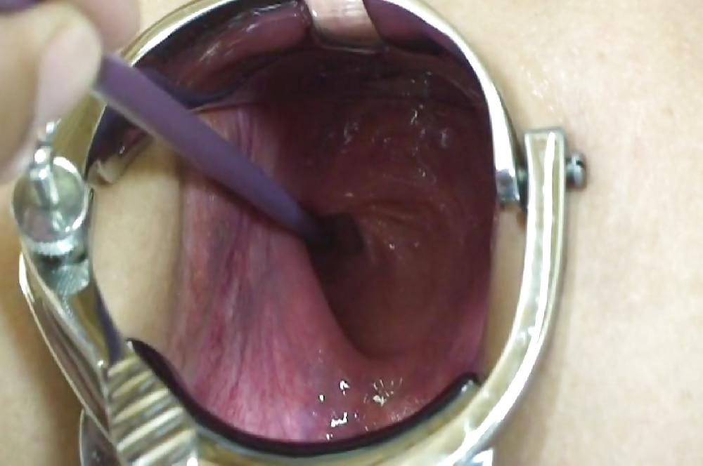 Free Pictures of incredible anal insertions by M.D.F. photos