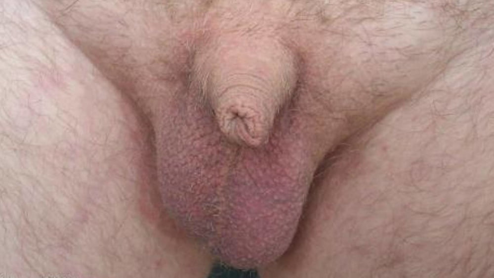 Soft And Small Uncut Cocks 301 Pics Xhamster