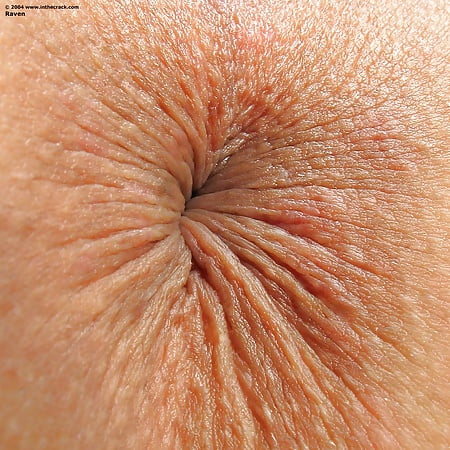 Anal Close Up Pictures