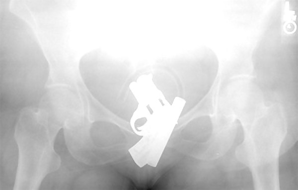 Free bad x-rays photos