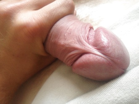 uncut natural foreskin