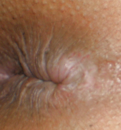 My nude teenage girlie butthole