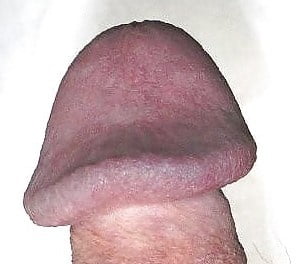 Huge Mushroom Head Cocks 85 Pics XHamster