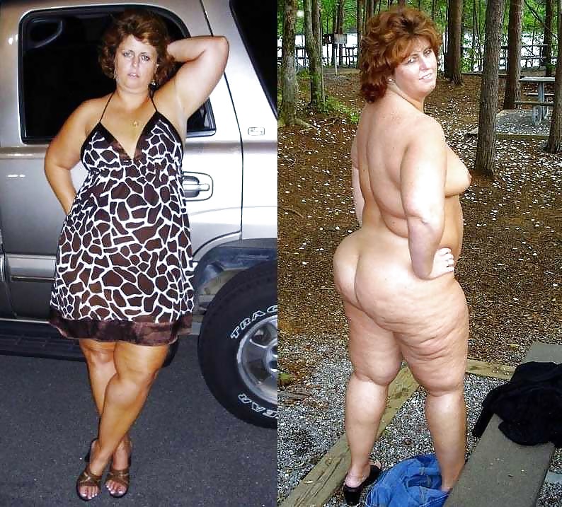 Free Before after 539 (Older women special) photos