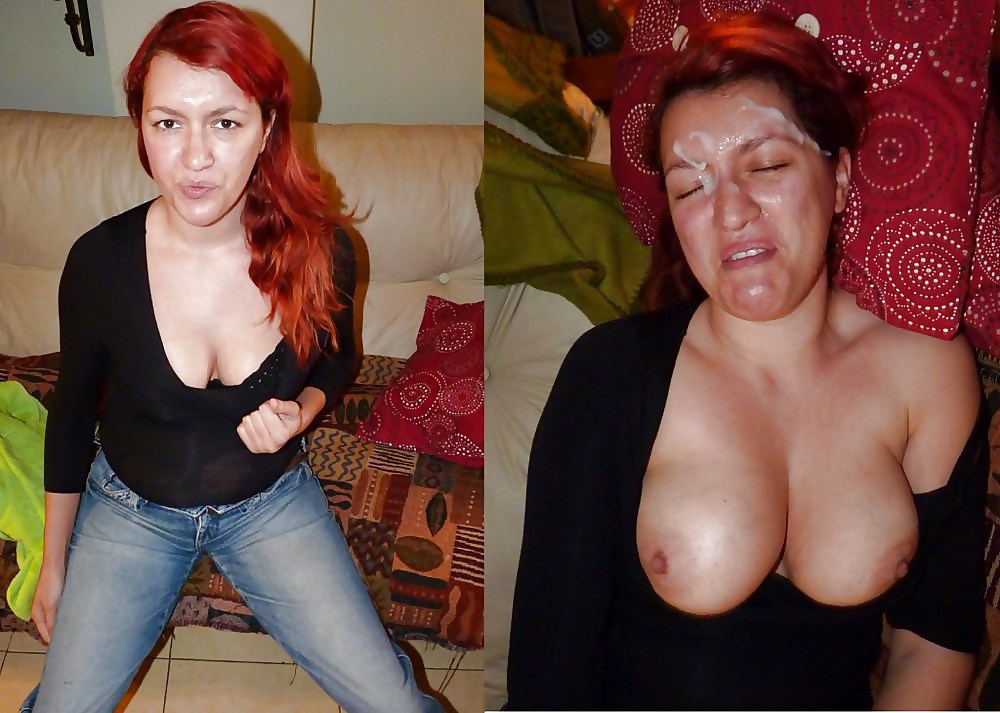 Free Before & After 3 photos