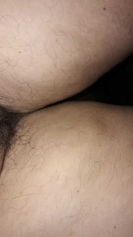 My hairy project- 3 Photos 