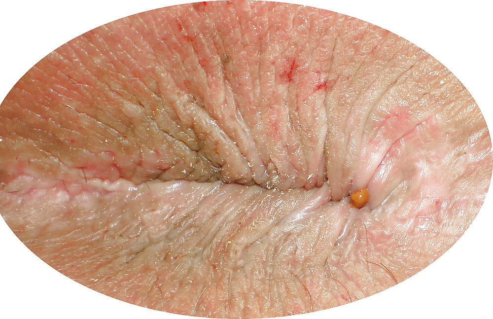 Free My 18 year old butthole (a few years ago) photos