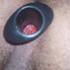 扩张器