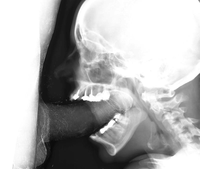 Free x-ray photos
