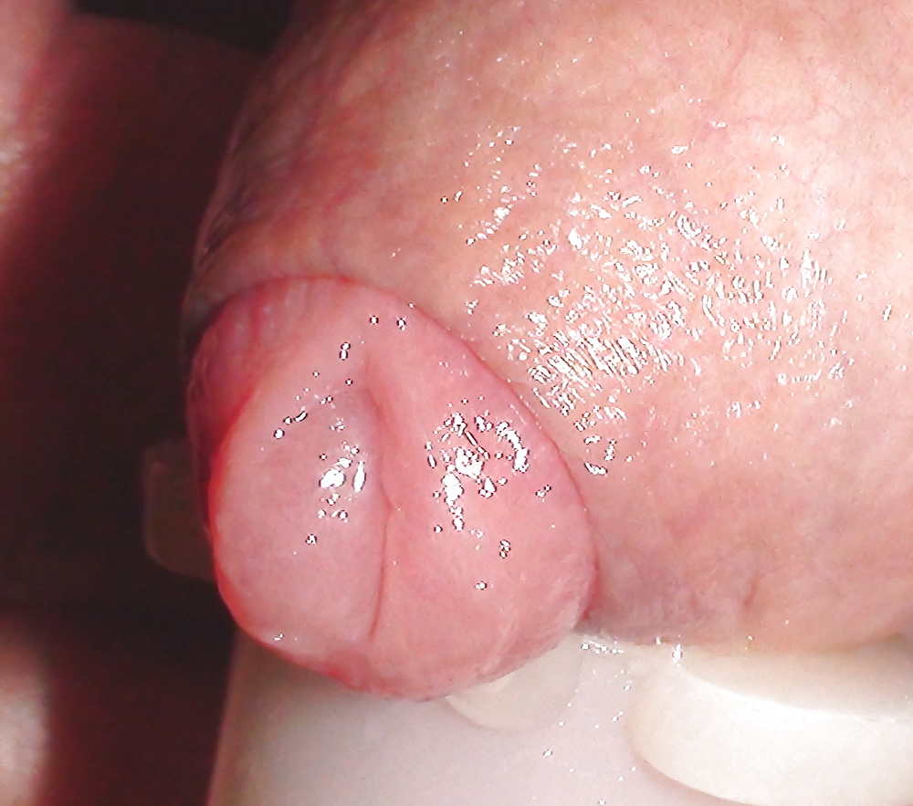 Free Tiny Penis Suction photos