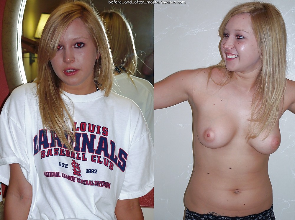 Free before and after pics - teens photos