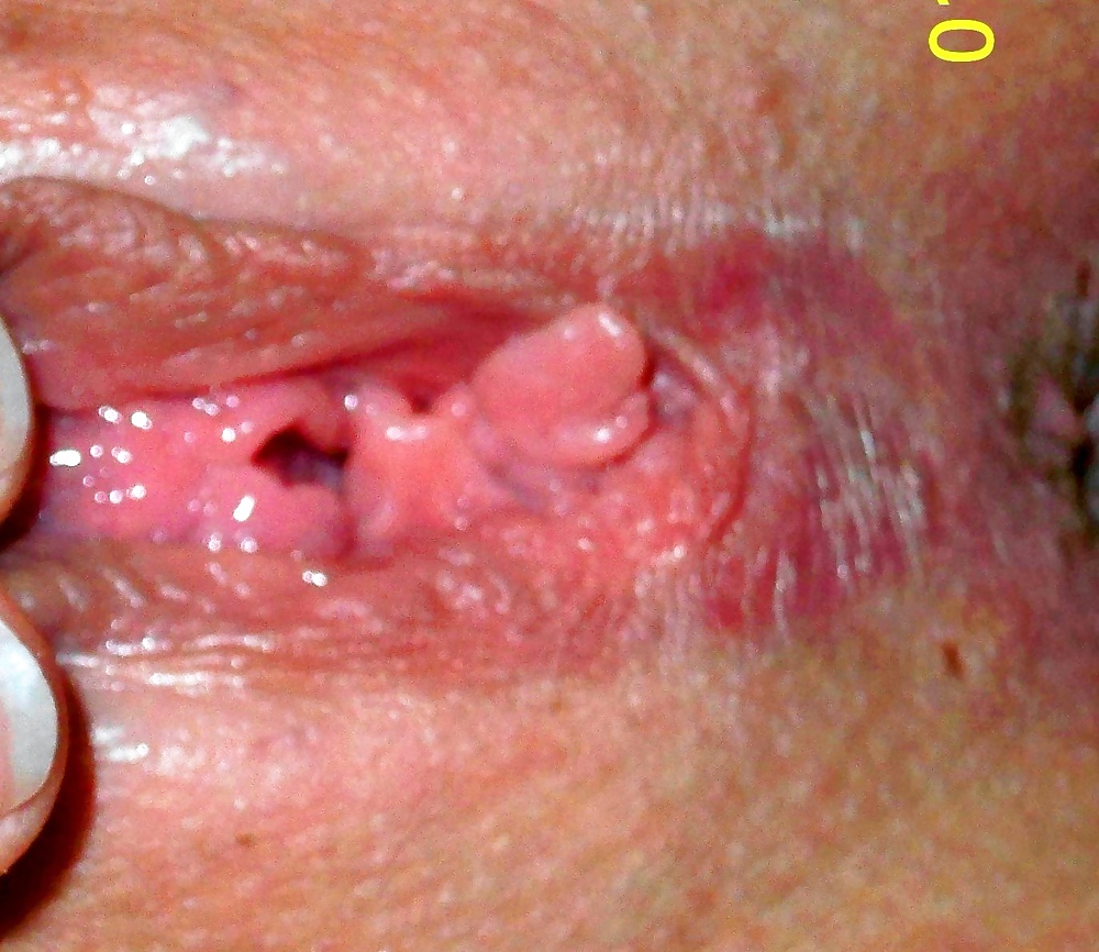 Free tasty holes photos