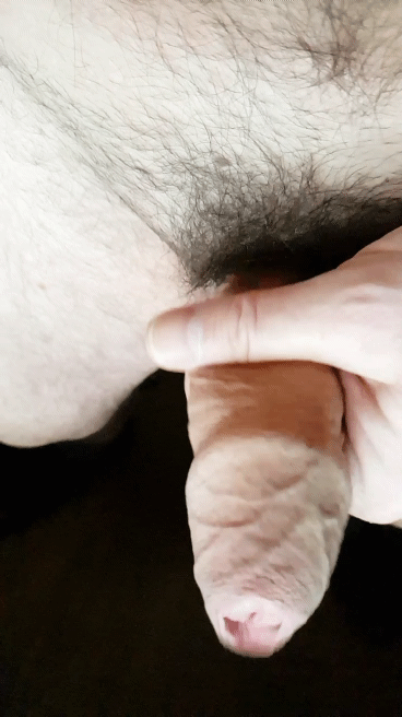 Masturbation With O Phimosis And With Tight Closed Foreskin