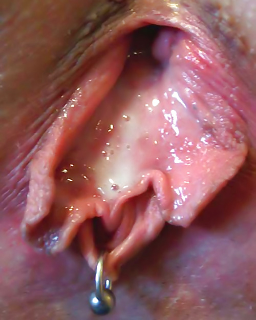 Teen anal creampie pictures