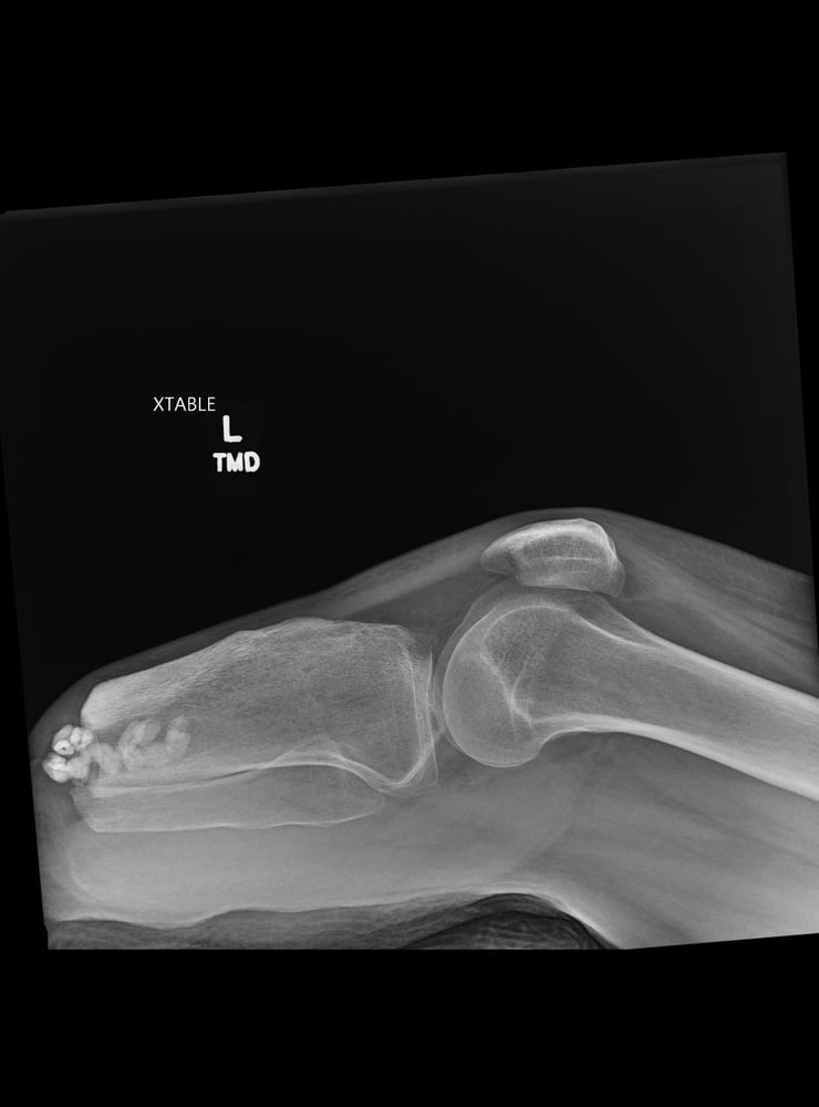 X-Ray- 15 Photos 
