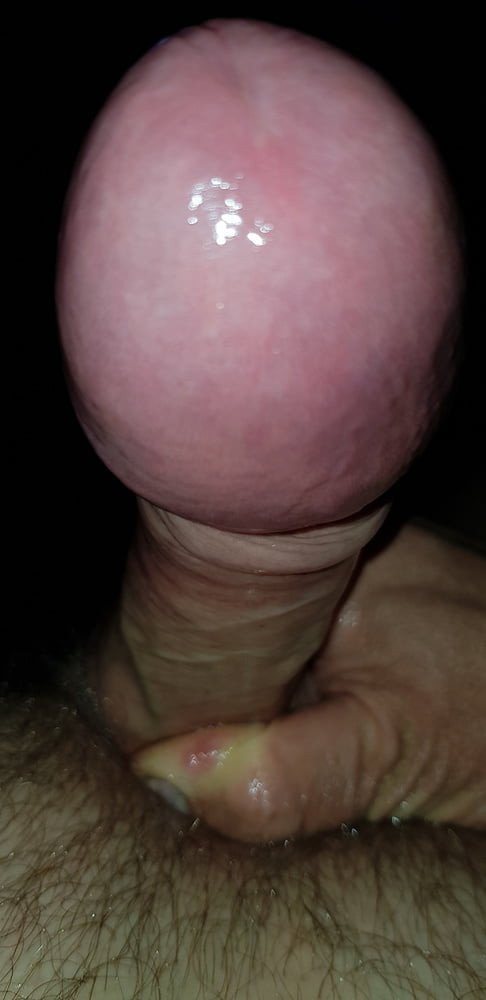 Mushroom Cock Head 63 Pics Xhamster 7739