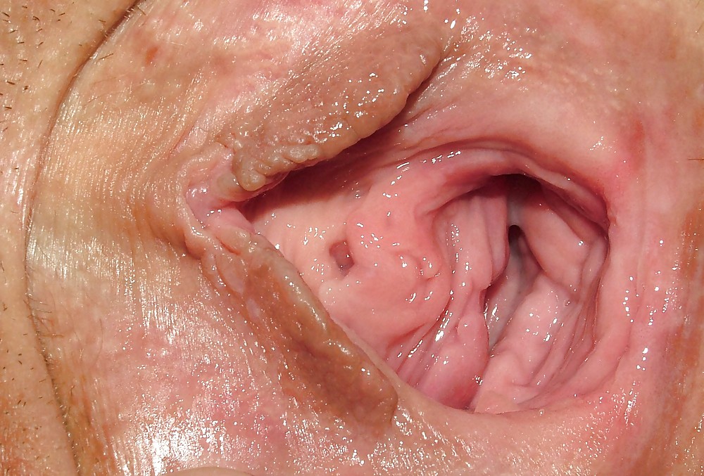 Small Hard Bump Inside Vagina.