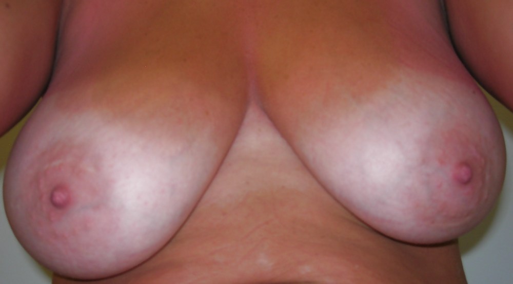 Free My Breasts With Tan Lines! photos